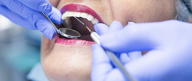 Best Emergency Dental Filling Replacement  in Marillo, CA
